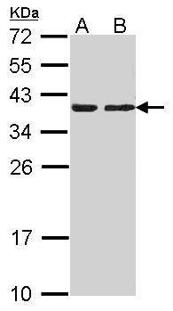 Anti-CAPZA2 antibody [N2C3] used in Western blot. GTX114303