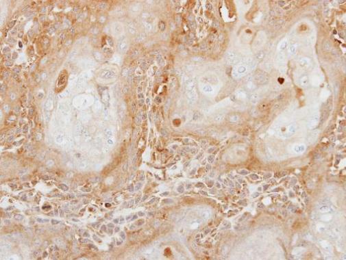 Anti-Carboxypeptidase B antibody [N3C3] used in IHC (Formalin-fixed paraffin-embedded sections). GTX114334