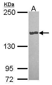 Anti-Carboxypeptidase D antibody [N2N3] used in Western blot. GTX114335