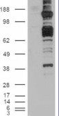 Anti-CARD11 antibody, C-term used in Western blot. GTX89813