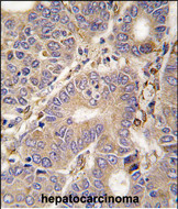 Anti-CARS2 antibody, C-term used in IHC (Formalin-fixed paraffin-embedded sections). GTX81274