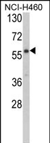 Anti-CARS2 antibody, C-term used in Western blot. GTX81274