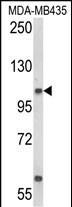 Anti-CASD1 antibody, N-term used in Western blot. GTX80980