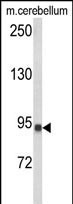 Anti-CASD1 antibody, N-term used in Western blot. GTX80980