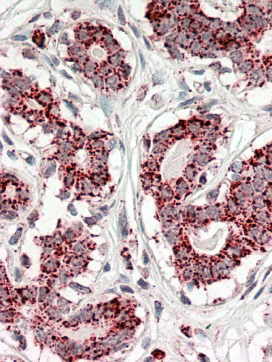 Anti-Aconitase 2 antibody, Internal used in IHC (Formalin-fixed paraffin-embedded sections). GTX88196