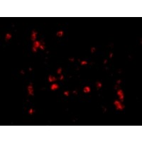 Anti-Cathelicidin antibody used in ICC/IF. GTX85418