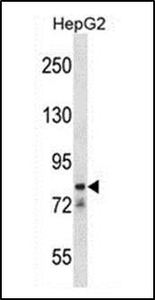 Anti-CATSPER1 antibody used in Western blot. GTX53484