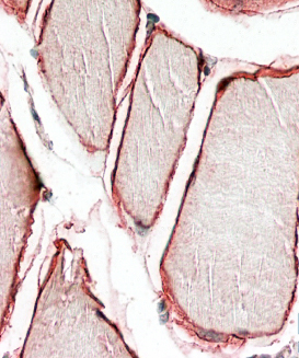 Anti-caveolin 3 antibody, N-term used in IHC (Formalin-fixed paraffin-embedded sections). GTX88437