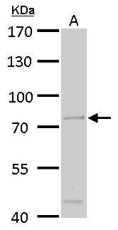 Anti-ACOX3 antibody used in Western blot. GTX115077