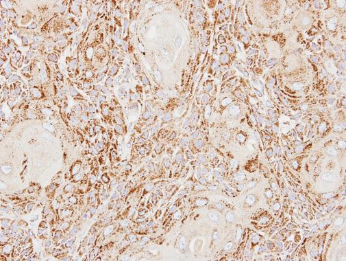 Anti-ACP2 antibody [N2C3] used in IHC (Formalin-fixed paraffin-embedded sections). GTX114234