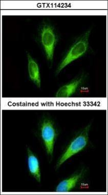 Anti-ACP2 antibody [N2C3] used in ICC/IF. GTX114234