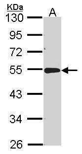 Anti-ACP2 antibody [N2C3] used in Western blot. GTX114234