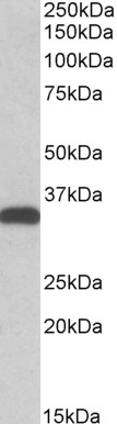 Anti-CBR3 antibody, C-term used in Western blot. GTX41958