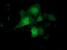 Anti-CBWD1 antibody [2D2] used in ICC/IF. GTX84727