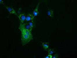 Anti-CBWD1 antibody [3F9] used in ICC/IF. GTX84732