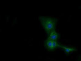 Anti-CBWD1 antibody [4D4] used in ICC/IF. GTX84735