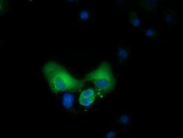 Anti-CBWD1 antibody [5H2] used in ICC/IF. GTX84733