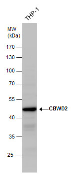 Anti-CBWD2 antibody used in Western blot. GTX120749