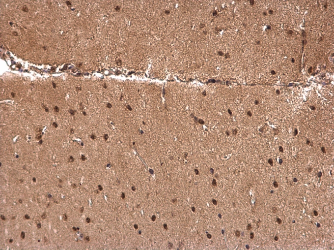 Anti-CCAR1 antibody used in IHC (Formalin-fixed paraffin-embedded sections). GTX110892