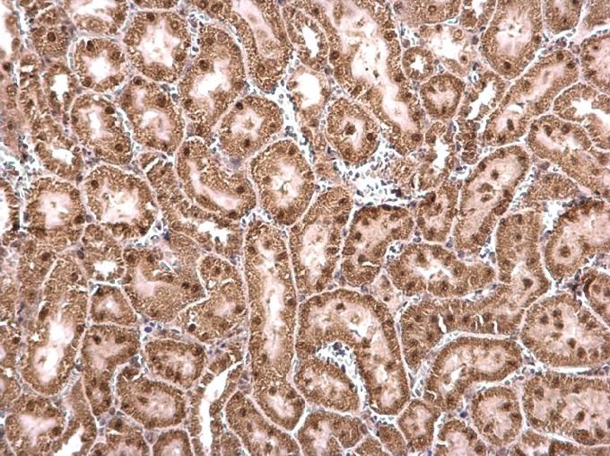 Anti-CCAR1 antibody used in IHC (Formalin-fixed paraffin-embedded sections). GTX110892