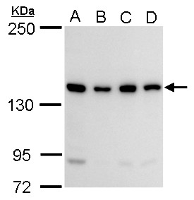 Anti-CCAR1 antibody used in Western blot. GTX110892