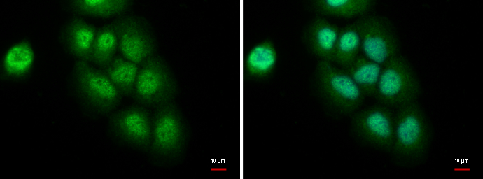 Anti-CCAR1 antibody used in ICC/IF. GTX110892