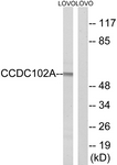 Anti-CCDC102A antibody used in Western blot. GTX87877