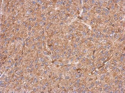 Anti-CCDC105 antibody [N2C2], Internal used in IHC (Formalin-fixed paraffin-embedded sections). GTX123024