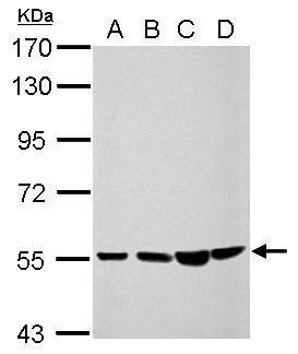 Anti-CCDC105 antibody [N2C2], Internal used in Western blot. GTX123024