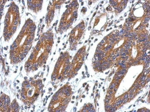 Anti-CCDC127 antibody used in IHC (Formalin-fixed paraffin-embedded sections). GTX122888