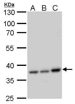 Anti-CCDC137 antibody used in Western blot. GTX120753