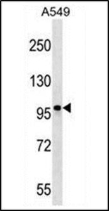 Anti-CCDC141 antibody used in Western blot. GTX53497
