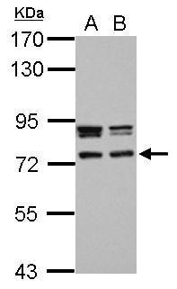 Anti-CCDC151 antibody used in Western blot. GTX122743