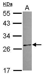 Anti-CCDC28B antibody [N1C3] used in Western blot. GTX119746