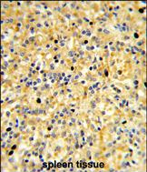 Anti-CCDC3 antibody, C-term used in IHC (Formalin-fixed paraffin-embedded sections). GTX81055