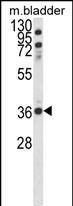 Anti-CCDC3 antibody, C-term used in Western blot. GTX81055