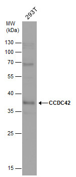 Anti-CCDC42 antibody used in Western blot. GTX120759