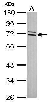 Anti-CCDC67 antibody [C1C3] used in Western blot. GTX120422