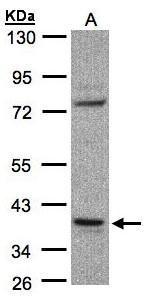 Anti-CCDC68 antibody [N2C3] used in Western blot. GTX106883