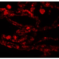 Anti-CCDC69 antibody used in ICC/IF. GTX85190