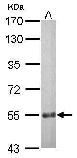 Anti-CCDC7 antibody [N1C1] used in Western blot. GTX121203