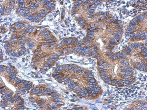 Anti-CCDC70 antibody [N1C3] used in IHC (Formalin-fixed paraffin-embedded sections). GTX120333