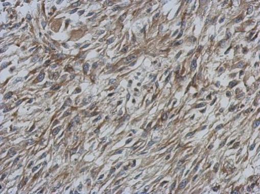 Anti-CCDC70 antibody [N1C3] used in IHC (Formalin-fixed paraffin-embedded sections). GTX120333