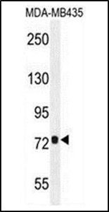 Anti-CCDC81 antibody used in Western blot. GTX53480