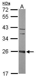 Anti-CCDC90B antibody [N1C2] used in Western blot. GTX119822
