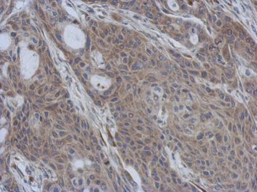Anti-CCDC90B antibody [N1C2] used in IHC (Formalin-fixed paraffin-embedded sections). GTX119822