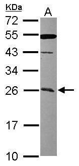Anti-CCDC90B antibody [N1C2] used in Western blot. GTX119822