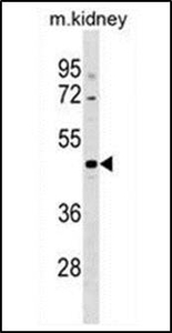 Anti-CCDC91 antibody used in Western blot. GTX53503