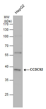 Anti-CCDC92 antibody used in Western blot. GTX120767