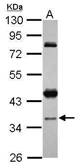 Anti-CCDC94 antibody [N2C3] used in Western blot. GTX120394